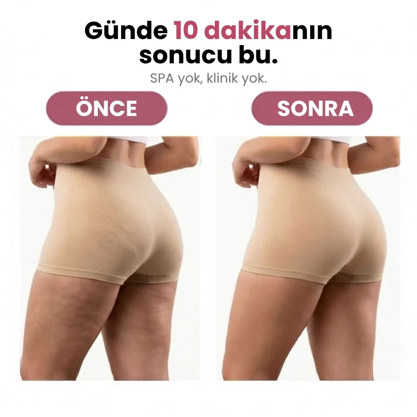 Slimvoya  Roller Anti-Selülit Masaj Cihazı